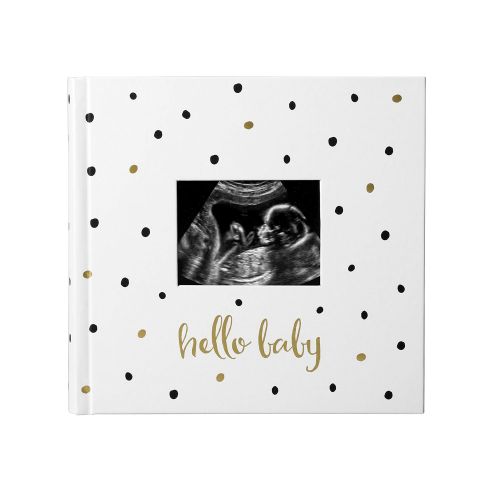  [아마존베스트]Pearhead Hello Baby Baby Photo Album, White/Black and Gold Polka Dot