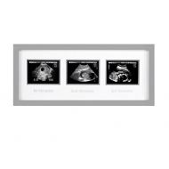 [아마존베스트]Pearhead Triple Sonogram Pregnancy Keepsake Frame, Watch Baby Grow Through All Three Trimesters - Great Gift for Expecting Parents, Grey