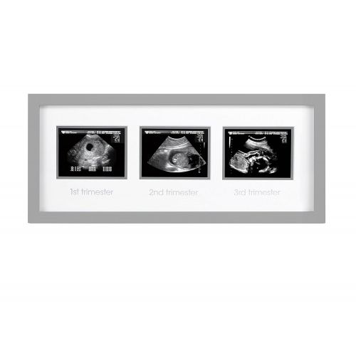  [아마존베스트]Pearhead Triple Sonogram Pregnancy Keepsake Frame, Watch Baby Grow Through All Three Trimesters - Great Gift for Expecting Parents, Grey