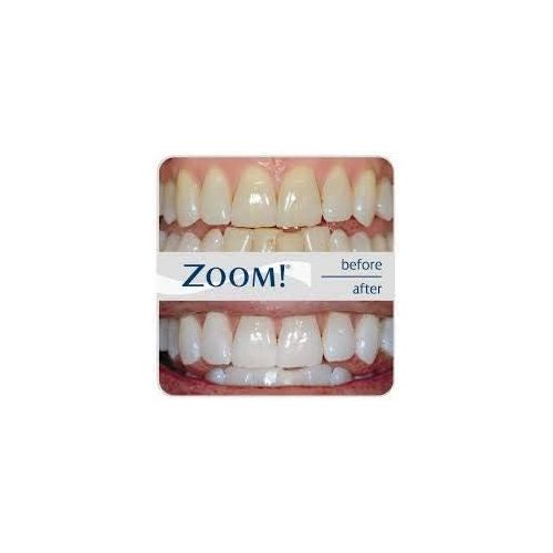 필립스 Philips Zoom 14% Teeth Whitening Gel 3 syringes Mint Flavor