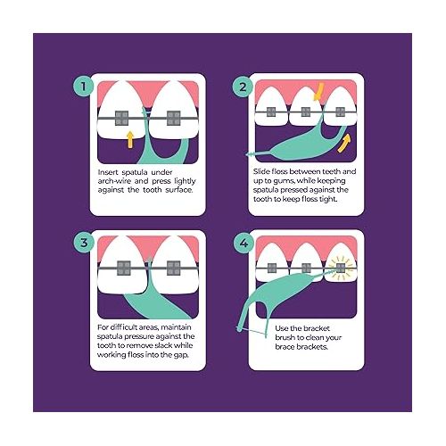  Platypus Orthodontic Flossers for Braces | Ortho Picks for Adults & Kids | Fits Under Arch Wire | Non-Damaging | Encourage Flossing Habits | Floss Teeth in Under Two Minutes (40 Count (Pack of 2))