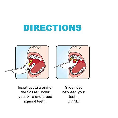  Platypus Orthodontic Flossers for Braces  Structure Fits Under Arch Wire, Floss Entire Mouth in Less Than 2 Minutes, Increases Flossing Compliance Over 84%- 75 Individually Wrappe