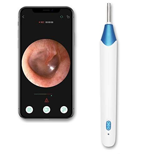  Protector Ear Camera, 720P HD Wireless Ear Scope, Super Light Lens WiFi Ear Endoscope, Ear Otoscope Camera with 3-Axis Gyroscope, Ear Wax Removal Endoscope, Compatible with Smartphone and Ta