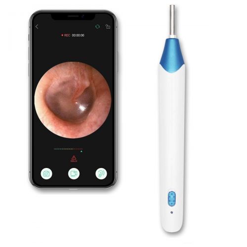  Protector Ear Camera, 720P HD Wireless Ear Scope, Super Light Lens WiFi Ear Endoscope, Ear Otoscope Camera with 3-Axis Gyroscope, Ear Wax Removal Endoscope, Compatible with Smartphone and Ta