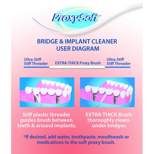  Proxysoft Dental Floss for Bridges and Implants, 12 Packs - Implant Floss Threaders for Bridges with Extra-Thick...