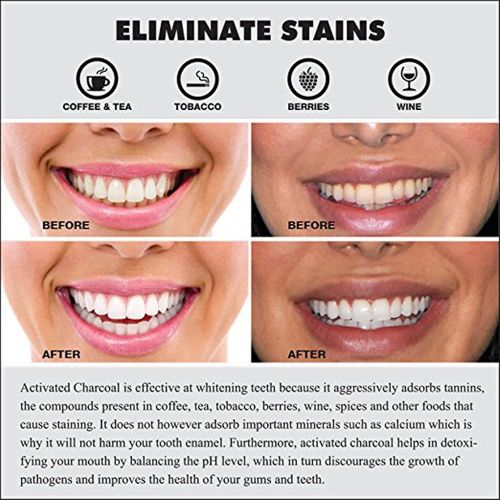  REMALI PLATINUM Activated Charcoal Teeth Whitening Powder - MADE IN USA from all...