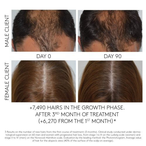  Rene Furterer Triphasic Progressive Concentrated Serum for Hormonal, Hereditary Thinning Hair