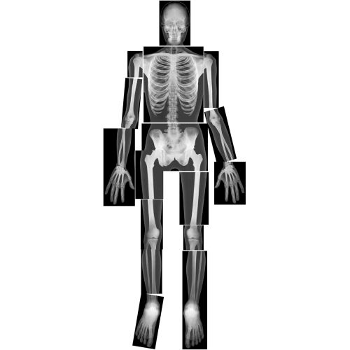  Roylco True to Life Human X-Rays