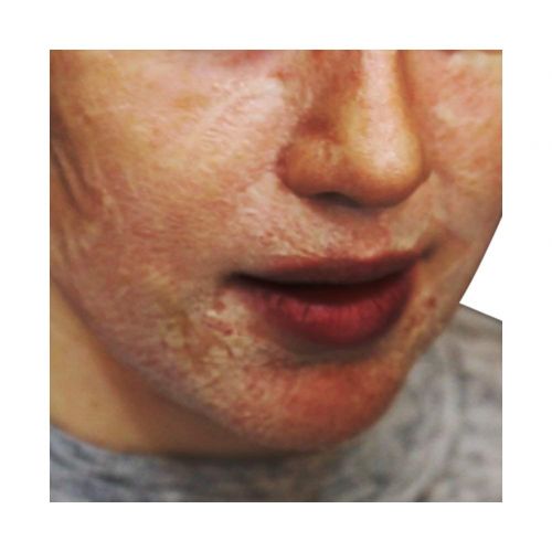  [아마존 핫딜]  [아마존핫딜]SKIN1004 Zombie Pack - Wash off Face Mask for Aging Skin, Fine Lines Wrinkles, Enlarged Pores, Dryness,...