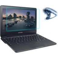 [아마존베스트]SKIONCE 17.3 Inch Laptop Screen Protector, Anti Blue Light Glare Filter for HP Envy 17.3/Pavilion 17.3, Acer Predator Helios/Acer Aspire 17.3, Dell/Lenovo/ASUS All 17.3 Inch 16:9 Aspect Ra