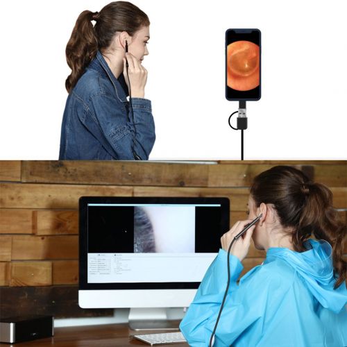  [아마존베스트]SOONHUA Otoscope,Ear Endoscope,Ear Wax Removal Tool,3 in 1 Ear Scope,720P HD Waterproof Camera with 6 Adjustable LED Lights for Android Phone (OTG+Micro USB+Type C) Window Mac PC with Ear