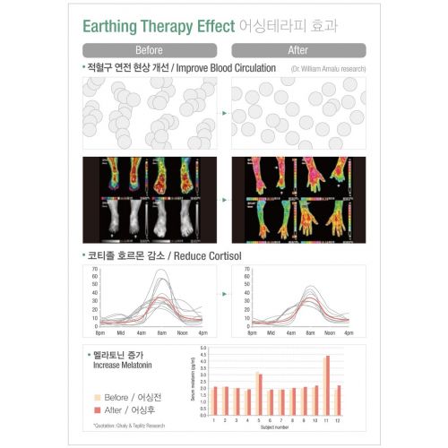  Shieldgreen shieldgreen-EMF,RF Shielding+Earthing Therapy Blanket-Modern Dot, Stainless Steel Yarn 25% EMF,RF shileiding Fabric+Earthing snap for grounding