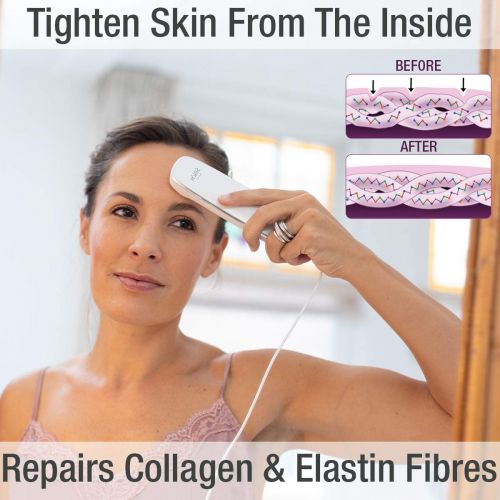  Silk’n Titan - At Home Anti-Aging Skin Care Device with Infrared and RF Energy and LED Light Therapy for Bright, Smooth Skin