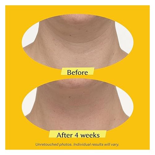  StriVectin Tighten & Lift Advanced Neck Cream PLUS with Alpha-3 Peptides™ for Neck & Decollete, Smoothing Look of Wrinkles & Fine Lines, Improves Crepey Skin & Vertical Lines, for Soft Smooth Skin