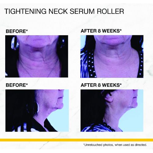  StriVectin Tightening Neck Serum Roller, 1.7 oz.