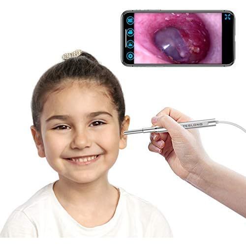  [아마존 핫딜]  [아마존핫딜]WiFi Otoscope for iPhone and Android, Teslong New Upgrade 4.3mm Visual Ear Cleaner with Wireless Adapter, Earwax Removal Tool, Washable Speculum Tips and Carrying Bag