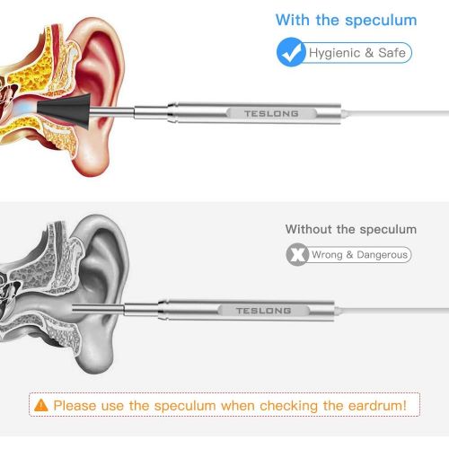  [아마존 핫딜]  [아마존핫딜]WiFi Otoscope for iPhone and Android, Teslong New Upgrade 4.3mm Visual Ear Cleaner with Wireless Adapter, Earwax Removal Tool, Washable Speculum Tips and Carrying Bag