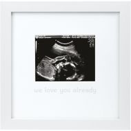 Tiny Ideas We Love You Already Sonogram Keepsake Photo Frame, White