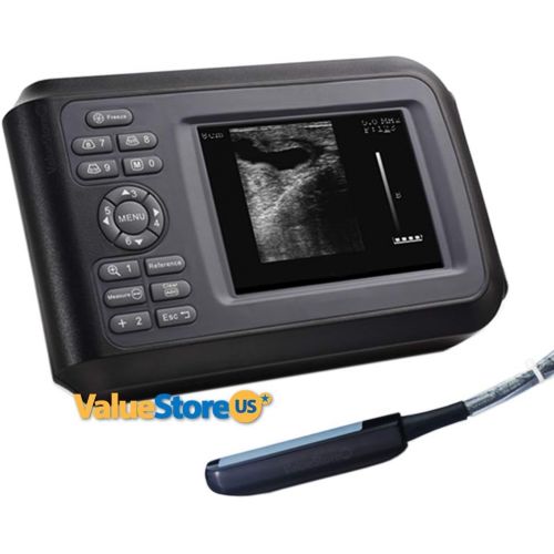  [아마존베스트]ValueStore.us Portable Ultrasound Scanner Veterinary Pregnancy V16 with 7.5 MHz Rectal Probe for Cattle, Horse, Camel, Equine, Goat, Cow and Sheep.