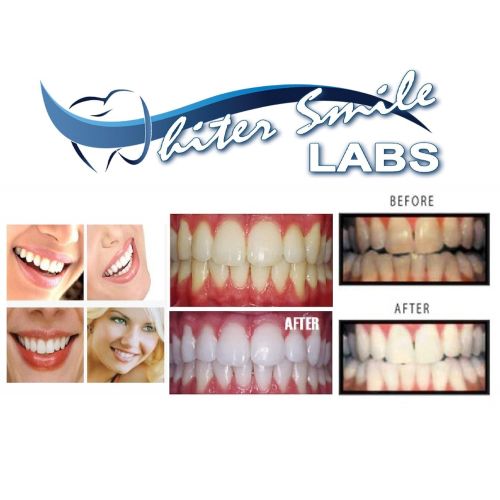  Whiter Smile Labs 38% Teeth Whitening Kit w/LED Light 5-XL Whitener Gels and 4 Bleaching Trays