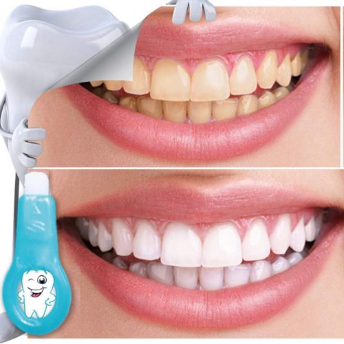  Yitrend Medical Teeth Whitening Pen - Safety Nano Oral Clean Teeth Whitener - Non Sensitive Teeth...
