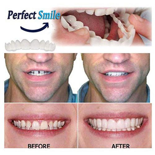  Z-YT Whitening Teeth, Beauty, Teeth, Smiling Teeth, Dental Care, Comfortable Dental Care, Instant Smiles, Suitable for Dental Top Veneers, Comfortable for Everyone