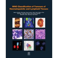 S Swerdlow; E Campo; N L Harris WHO Classification of Tumours of Haematopoietic and Lymphoid Tissues