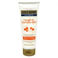 Walgreens Gold Bond Rough Bumpy Skin Therapy Lotion