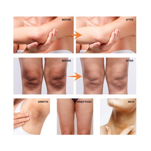  [아마존 핫딜] [아마존핫딜]Whitening Cream for Armpits, Intimate Parts, Between Legs - with Collagen - Effective Lightening Cream - Brightens, Nourishes, Moisturizes Underarm, Neck, Knees, Elbows by AsaVea