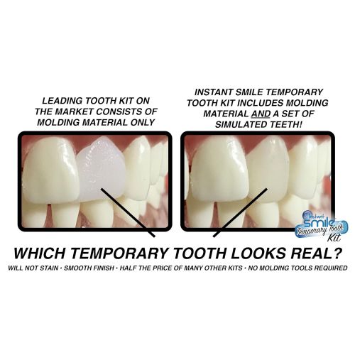  InstaMorph Instant Smile Temporary Tooth Kit - 3 Shades Included (Bright, Natural, Dark) - Does Not Stain and PATENTED!!